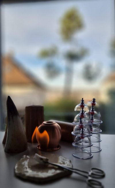 Schröpfgläser zum Schröpfen in der Praxis e n d e r û n in Stuttgart