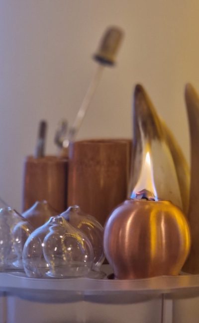 Schröpfgläser und Zubehör für traditionelles Schröpfen in der Praxis e n d e r û n in Stuttgart